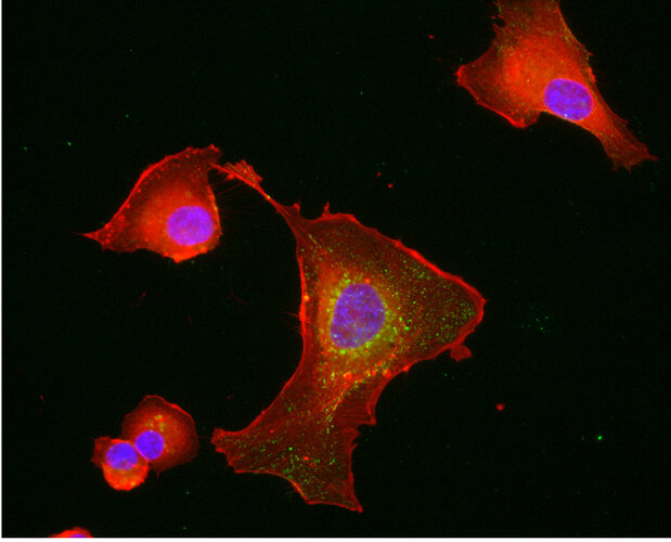 Endothelial cells